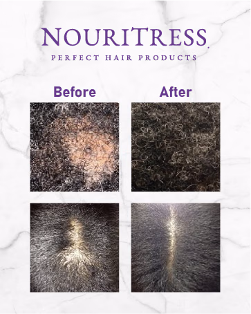 NouriTress — Brand Story card 11